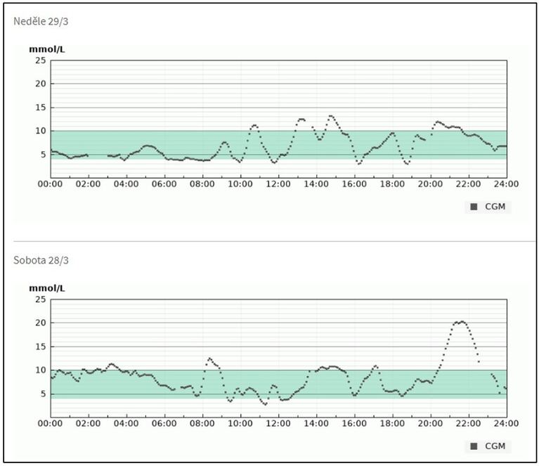 Záznam z kontinuálního monitoru glykémie zobrazený systémem Diasend